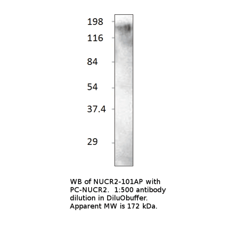 Anti-KAT13C / NCOA2 Antibody from FabGennix (NUCR2-101AP) - Antibodies.com