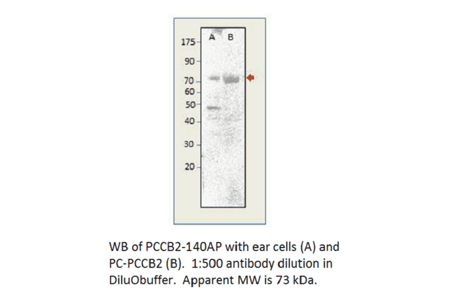 Anti-Phospho-CACNB2 Antibody from FabGennix (PCCB2-140AP) - Antibodies.com