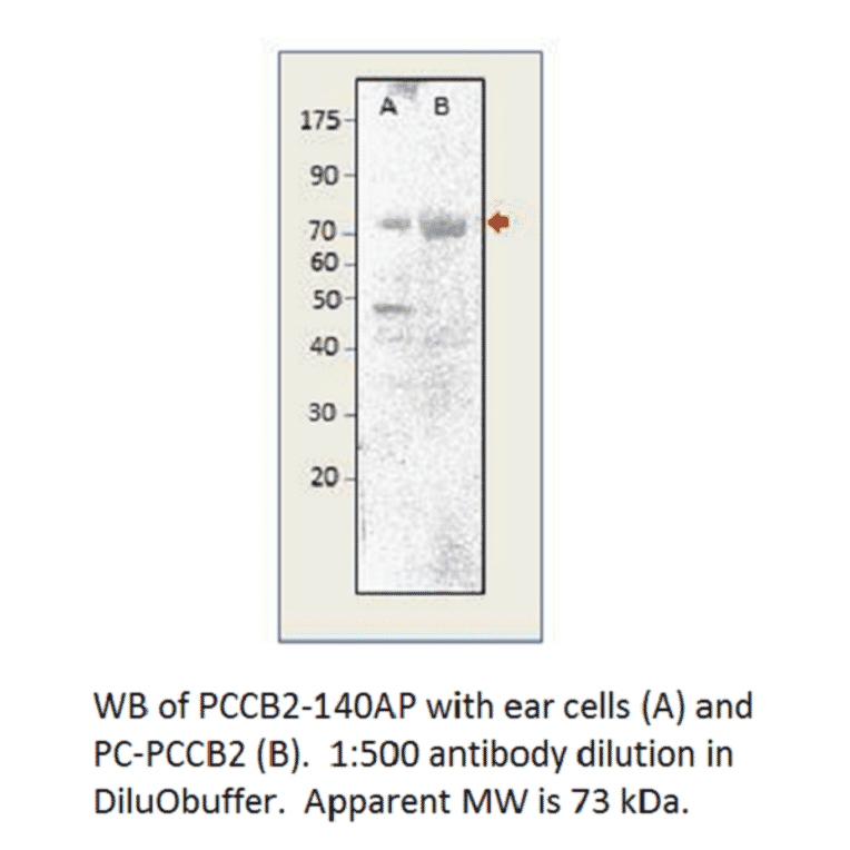 Anti-Phospho-CACNB2 Antibody from FabGennix (PCCB2-140AP) - Antibodies.com