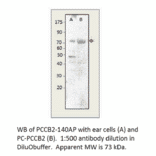 Anti-Phospho-CACNB2 Antibody from FabGennix (PCCB2-140AP) - Antibodies.com