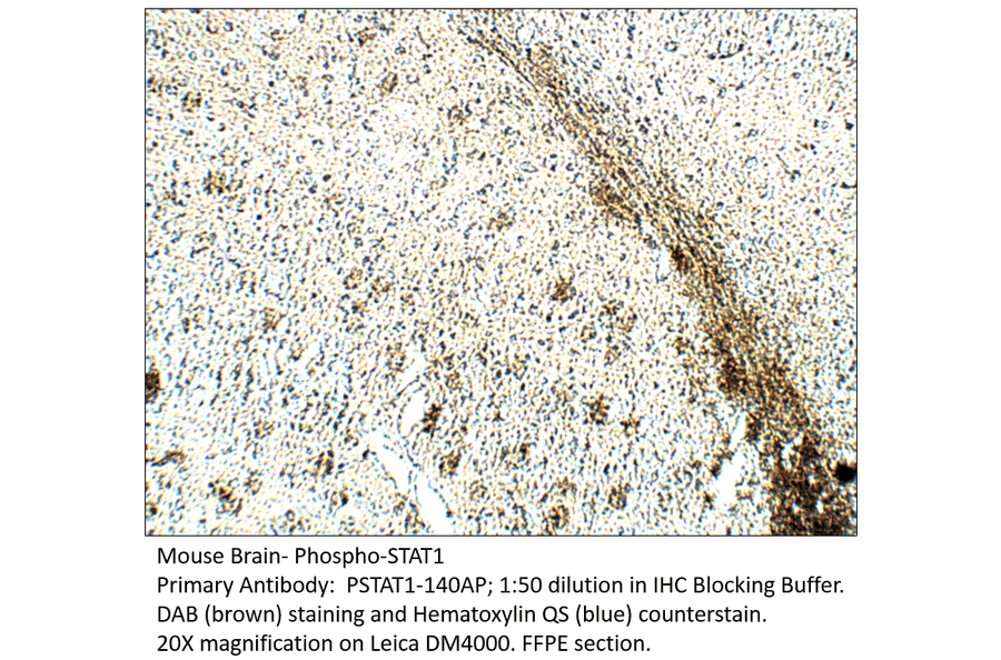 Anti-Phospho-STAT1 Antibody from FabGennix (PSTAT1-140AP) - Antibodies.com