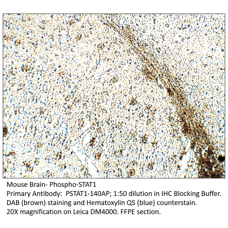 Anti-Phospho-STAT1 Antibody from FabGennix (PSTAT1-140AP) - Antibodies.com