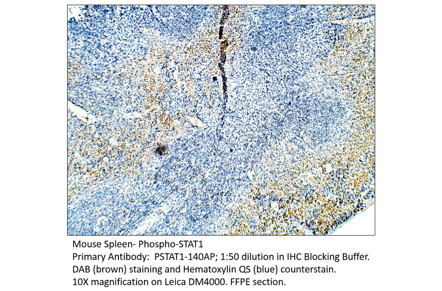 Anti-Phospho-STAT1 Antibody from FabGennix (PSTAT1-140AP) - Antibodies.com