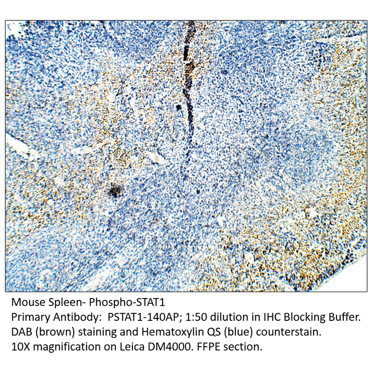 Anti-Phospho-STAT1 Antibody from FabGennix (PSTAT1-140AP) - Antibodies.com