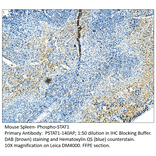 Anti-Phospho-STAT1 Antibody from FabGennix (PSTAT1-140AP) - Antibodies.com