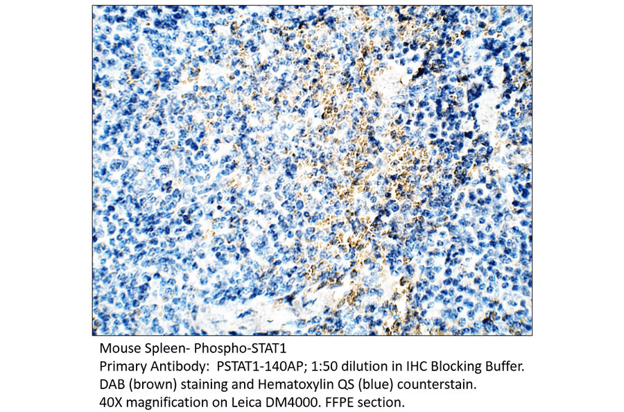 Anti-Phospho-STAT1 Antibody from FabGennix (PSTAT1-140AP) - Antibodies.com