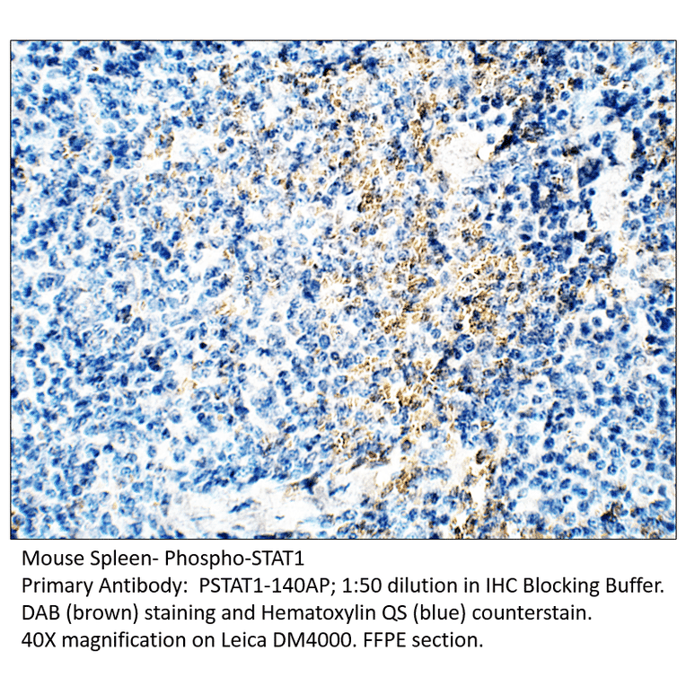 Anti-Phospho-STAT1 Antibody from FabGennix (PSTAT1-140AP) - Antibodies.com