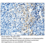 Anti-Phospho-STAT1 Antibody from FabGennix (PSTAT1-140AP) - Antibodies.com