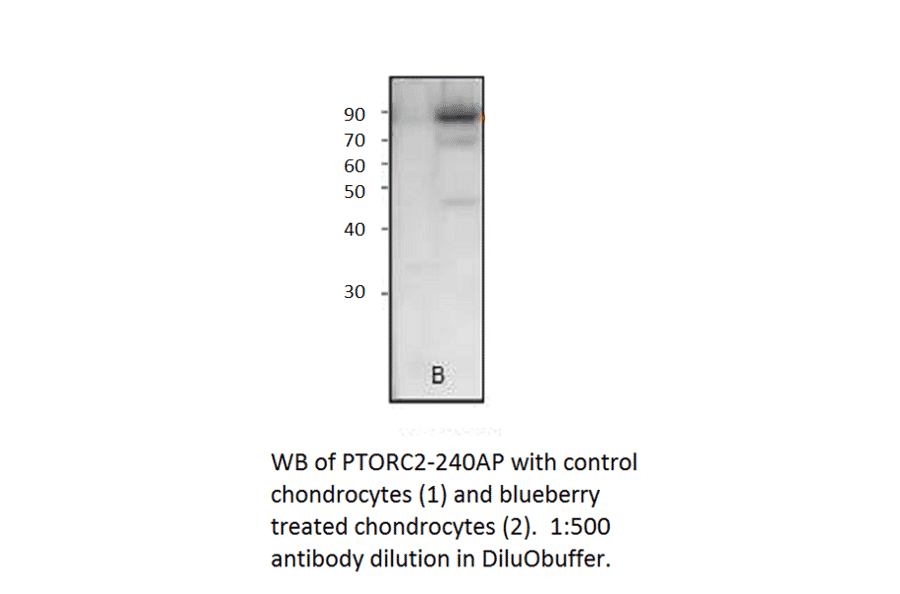 Anti-Phospho-TORC2 Antibody from FabGennix (PTORC2-140AP) - Antibodies.com