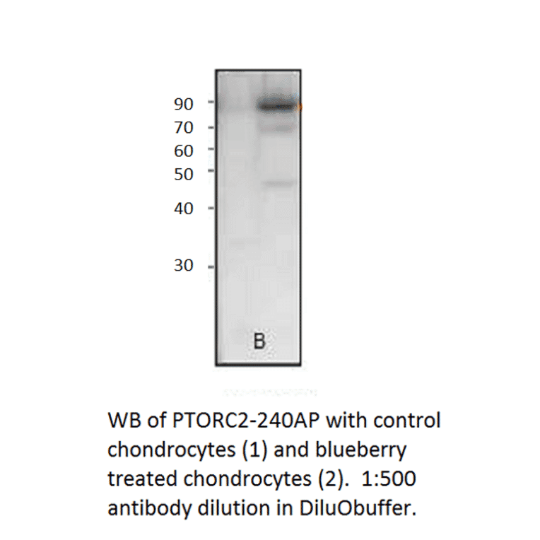 Anti-Phospho-TORC2 Antibody from FabGennix (PTORC2-140AP) - Antibodies.com