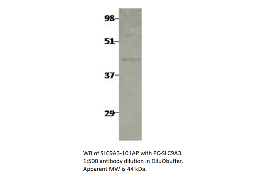 Anti-Sodium/Hydrogen Exchanger 3 Antibody from FabGennix (SLC9A3-101AP) - Antibodies.com