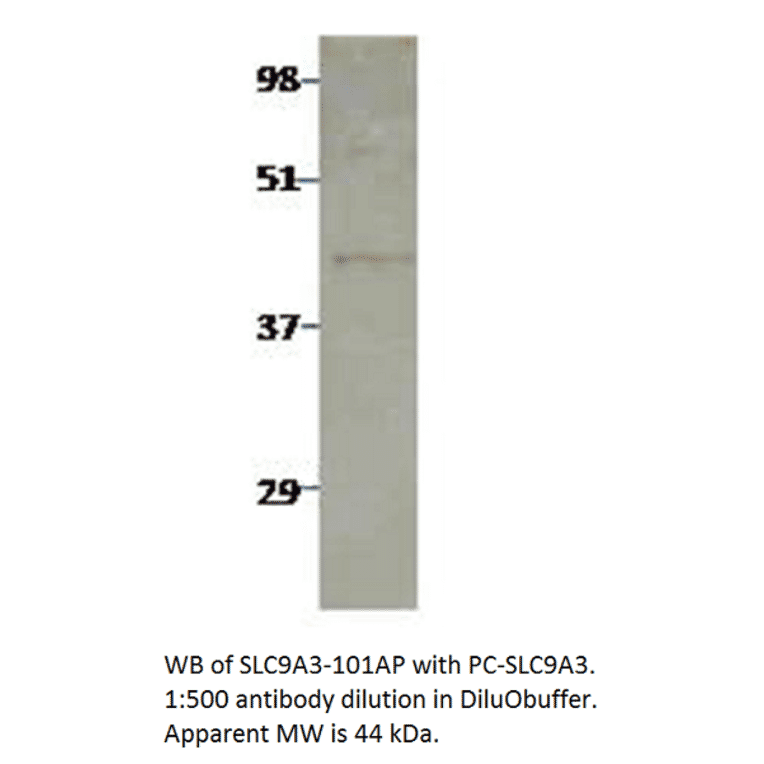 Anti-Sodium/Hydrogen Exchanger 3 Antibody from FabGennix (SLC9A3-101AP) - Antibodies.com