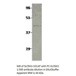 Anti-Sodium/Hydrogen Exchanger 3 Antibody from FabGennix (SLC9A3-101AP) - Antibodies.com