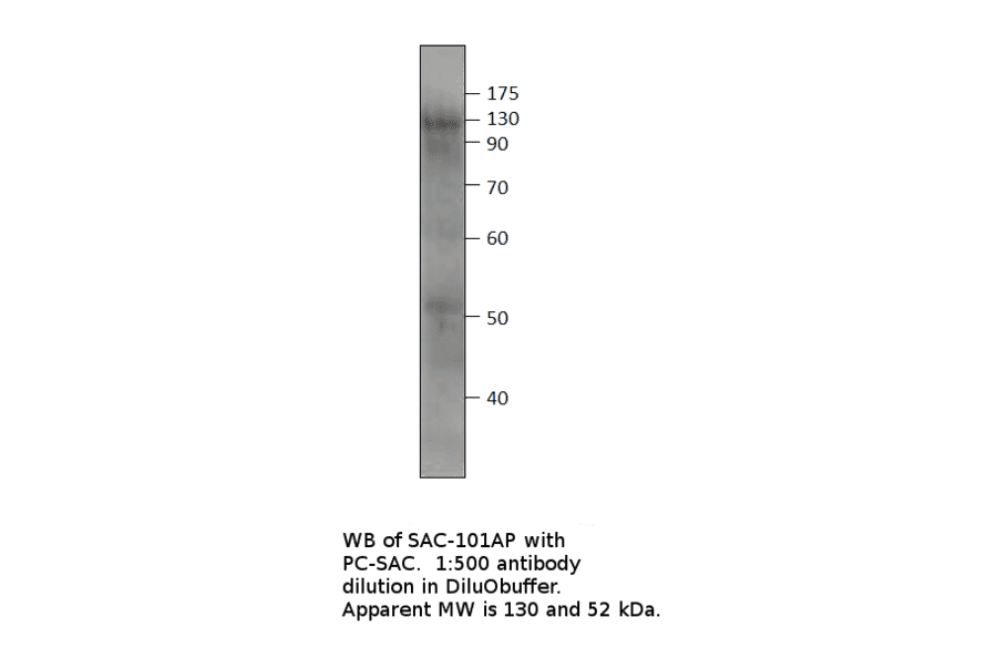 Anti-Soluble Adenylate Cyclase 1 Antibody from FabGennix (SAC-101AP) - Antibodies.com