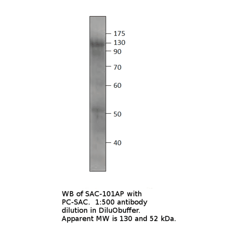 Anti-Soluble Adenylate Cyclase 1 Antibody from FabGennix (SAC-101AP) - Antibodies.com