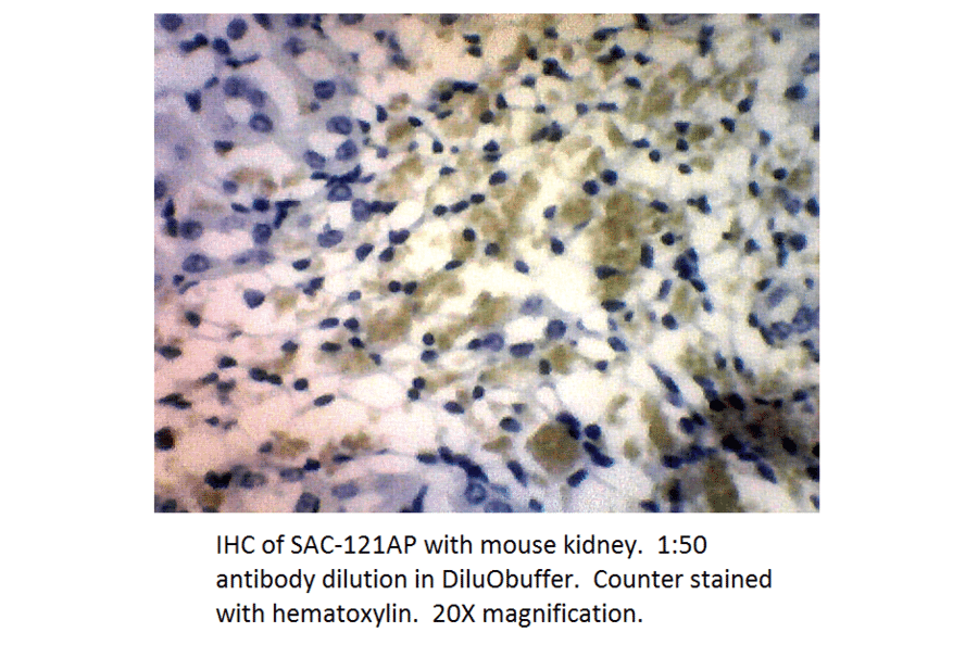 Anti-Soluble Adenylate Cyclase 1 Antibody from FabGennix (SAC-121AP) - Antibodies.com