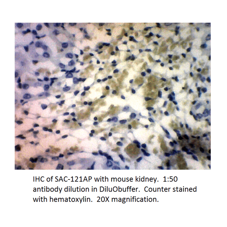 Anti-Soluble Adenylate Cyclase 1 Antibody from FabGennix (SAC-121AP) - Antibodies.com