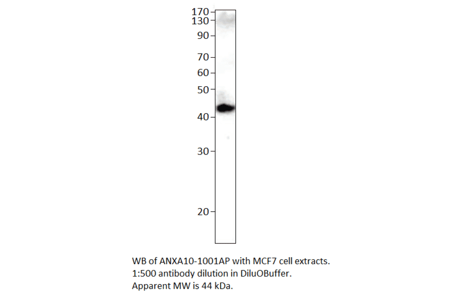 Anti-Annexin A10 Antibody from FabGennix (ANXA10-1001AP) - Antibodies.com