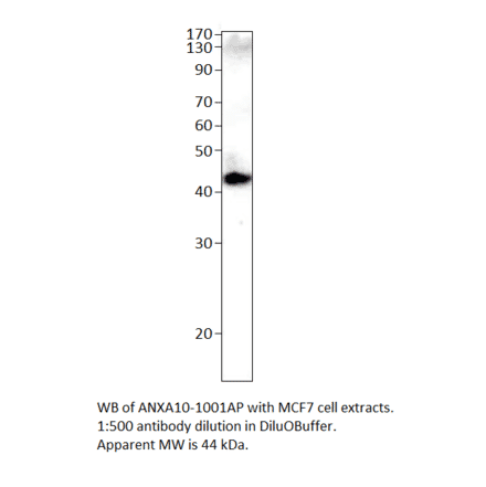 Anti-Annexin A10 Antibody from FabGennix (ANXA10-1001AP) - Antibodies.com