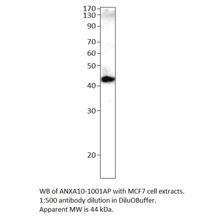 Anti-Annexin A10 Antibody from FabGennix (ANXA10-1001AP) - Antibodies.com