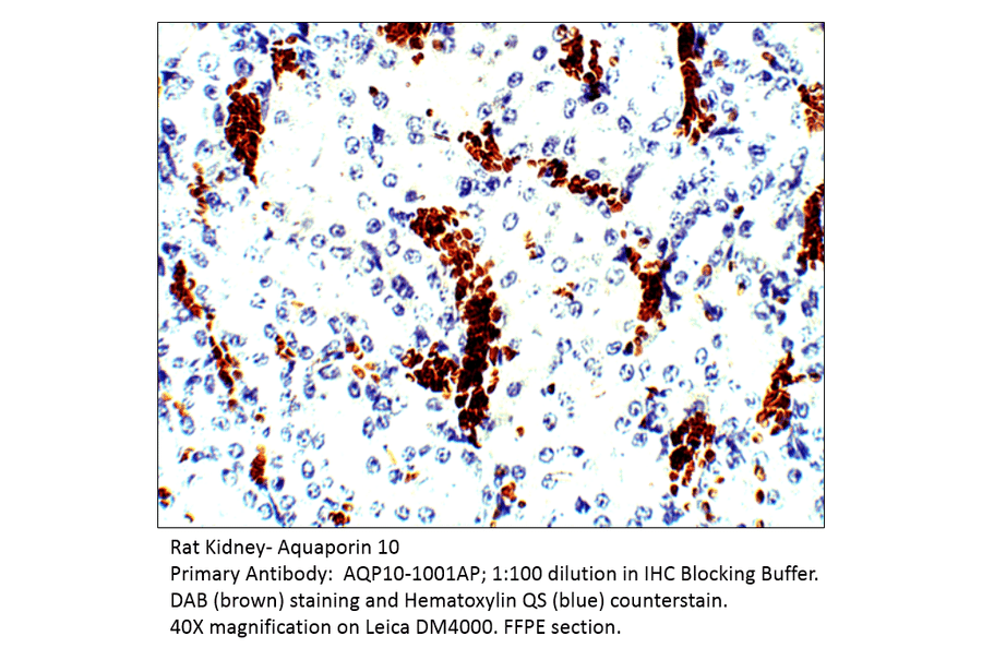 Anti-Aquaporin 10 Antibody from FabGennix (AQP10-1001AP) - Antibodies.com