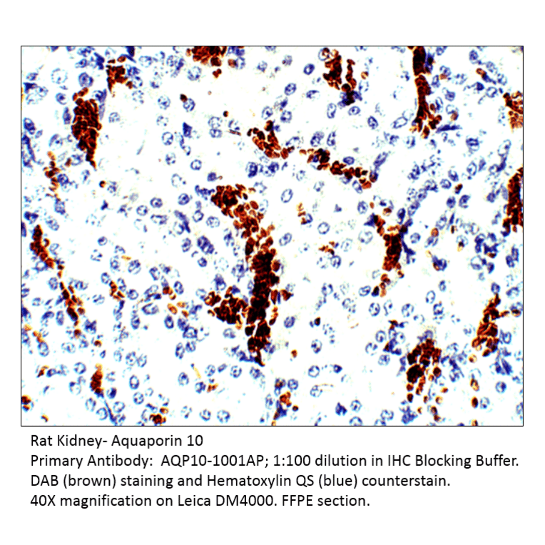 Anti-Aquaporin 10 Antibody from FabGennix (AQP10-1001AP) - Antibodies.com