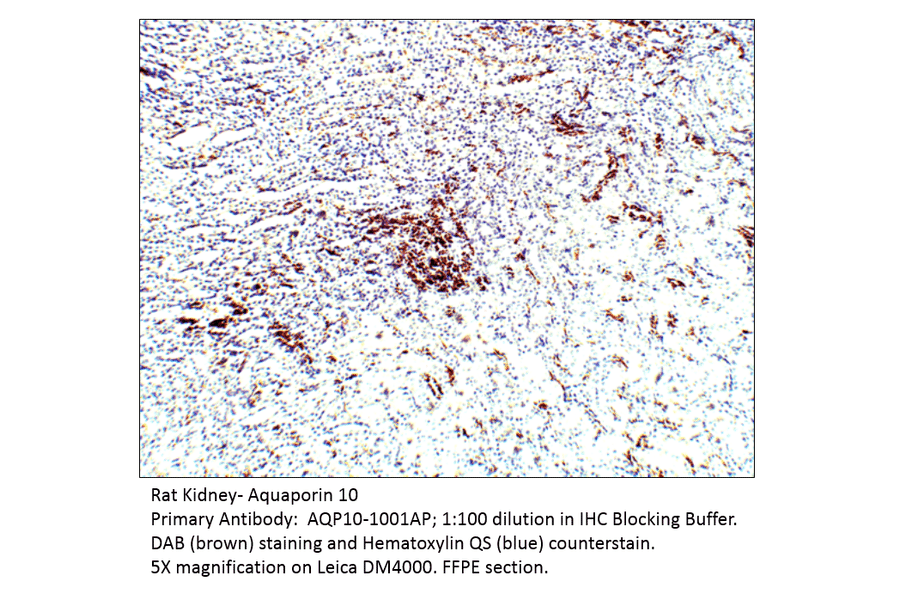 Anti-Aquaporin 10 Antibody from FabGennix (AQP10-1001AP) - Antibodies.com
