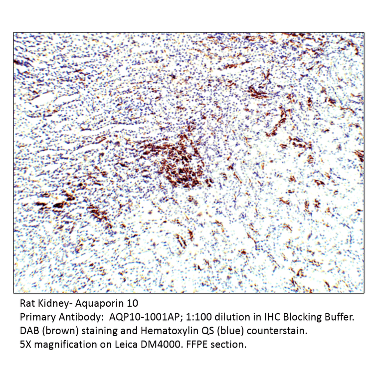 Anti-Aquaporin 10 Antibody from FabGennix (AQP10-1001AP) - Antibodies.com
