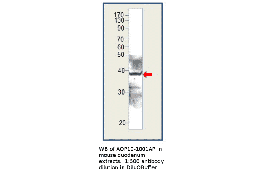 Anti-Aquaporin 10 Antibody from FabGennix (AQP10-1001AP) - Antibodies.com