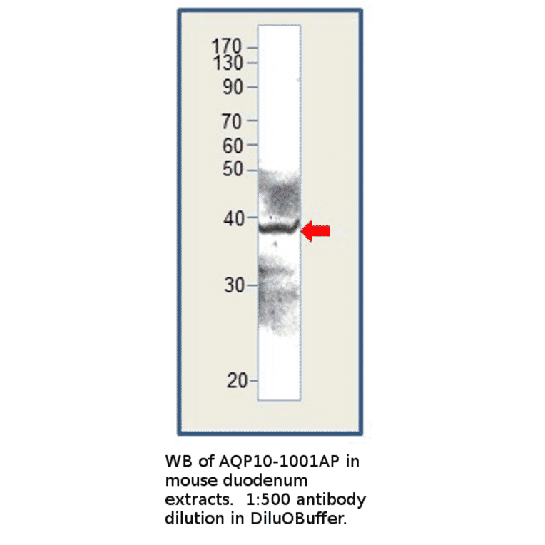 Anti-Aquaporin 10 Antibody from FabGennix (AQP10-1001AP) - Antibodies.com