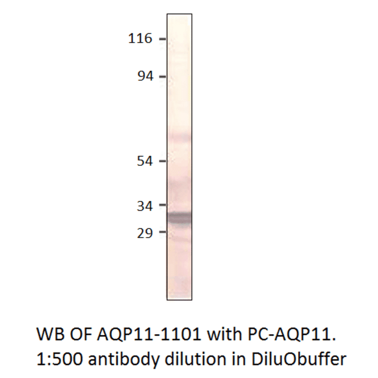 Anti-Aquaporin 11 Antibody from FabGennix (AQP11-1101AP) - Antibodies.com