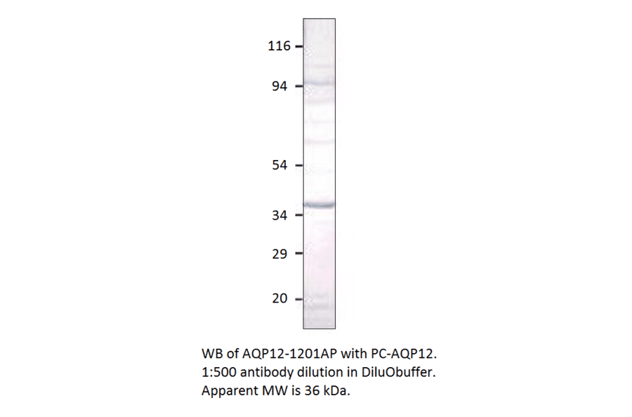 Anti-Aquaporin 12 Antibody from FabGennix (AQP12-1201AP) - Antibodies.com