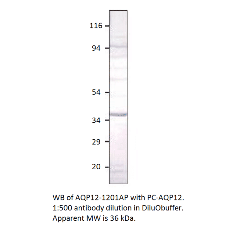 Anti-Aquaporin 12 Antibody from FabGennix (AQP12-1201AP) - Antibodies.com
