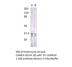Anti-CaMKII gamma Antibody from FabGennix (CAMKII-301AP) - Antibodies.com