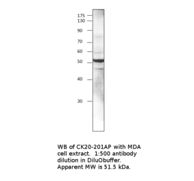 Anti-Cytokeratin 20 Antibody from FabGennix (CK20-101AP) - Antibodies.com