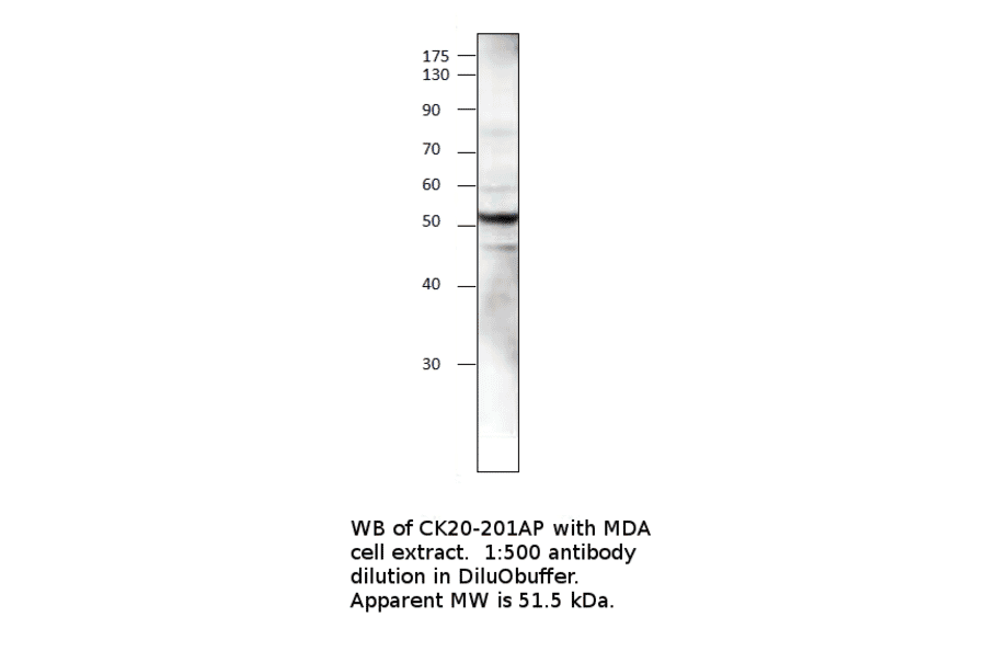 Anti-Cytokeratin 20 Antibody from FabGennix (CK20-101AP) - Antibodies.com