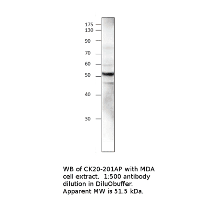 Anti-Cytokeratin 20 Antibody from FabGennix (CK20-101AP) - Antibodies.com