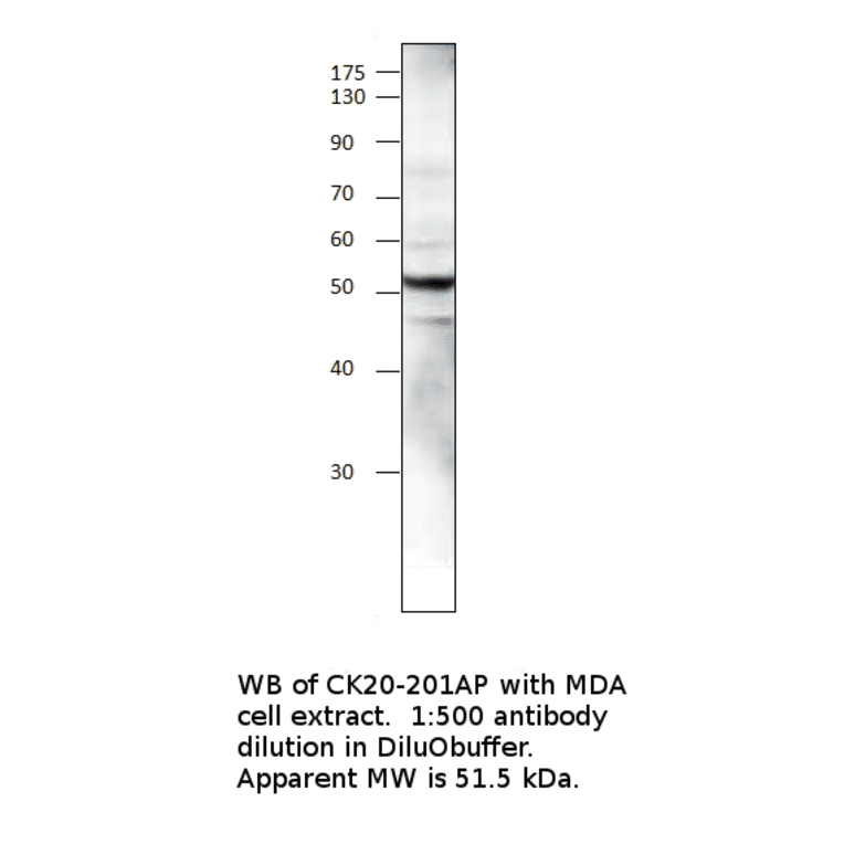Anti-Cytokeratin 20 Antibody from FabGennix (CK20-101AP) - Antibodies.com
