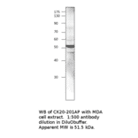 Anti-Cytokeratin 20 Antibody from FabGennix (CK20-101AP) - Antibodies.com
