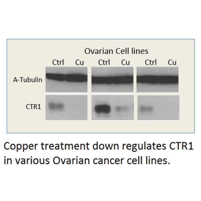 Anti-CTR1 / SLC31A1 Antibody from FabGennix (CTR1-101AP) - Antibodies.com