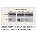 Anti-CTR1 / SLC31A1 Antibody from FabGennix (CTR1-101AP) - Antibodies.com