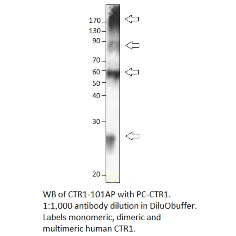 Anti-CTR1 / SLC31A1 Antibody from FabGennix (CTR1-101AP) - Antibodies.com