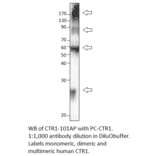 Anti-CTR1 / SLC31A1 Antibody from FabGennix (CTR1-101AP) - Antibodies.com