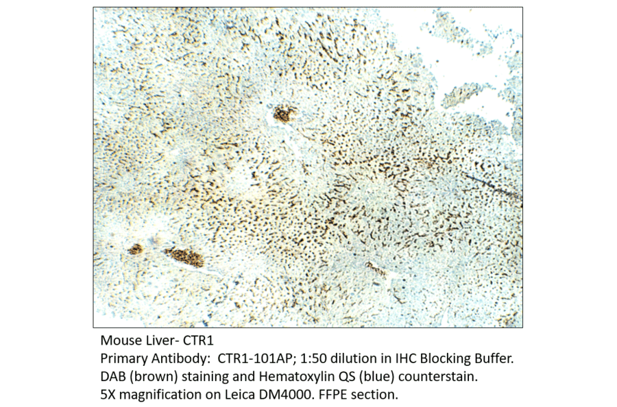 Anti-CTR1 / SLC31A1 Antibody from FabGennix (CTR1-101AP) - Antibodies.com