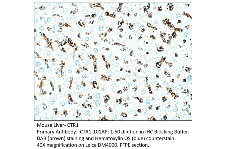 Anti-CTR1 / SLC31A1 Antibody from FabGennix (CTR1-101AP) - Antibodies.com
