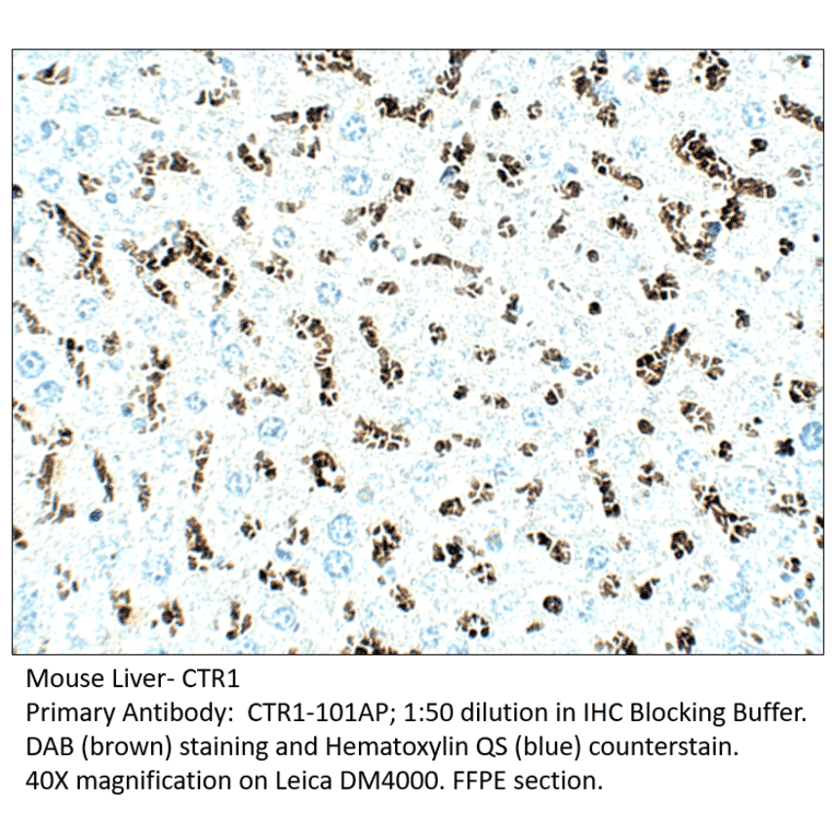 Anti-CTR1 / SLC31A1 Antibody from FabGennix (CTR1-101AP) - Antibodies.com