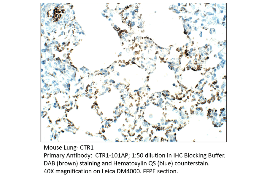 Anti-CTR1 / SLC31A1 Antibody from FabGennix (CTR1-101AP) - Antibodies.com