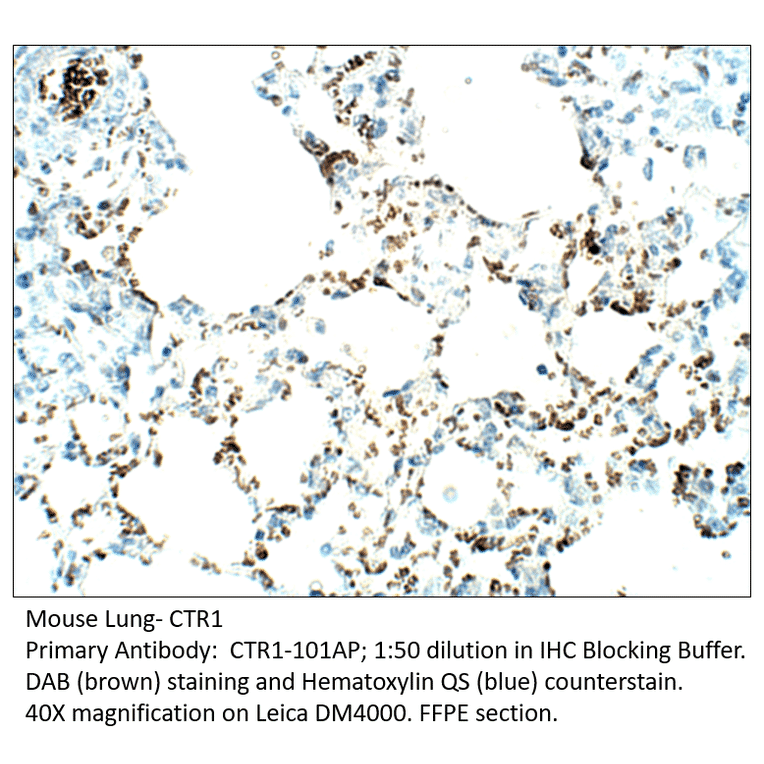 Anti-CTR1 / SLC31A1 Antibody from FabGennix (CTR1-101AP) - Antibodies.com
