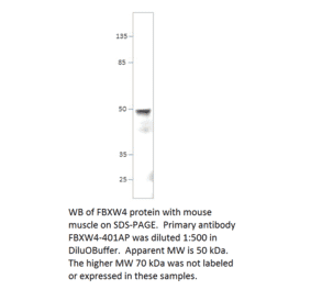 Anti-FBXW4 / SHFM3 Antibody from FabGennix (FBXW4-401AP) - Antibodies.com