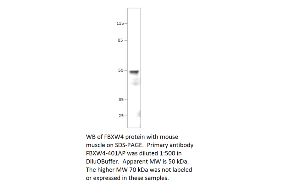 Anti-FBXW4 / SHFM3 Antibody from FabGennix (FBXW4-401AP) - Antibodies.com